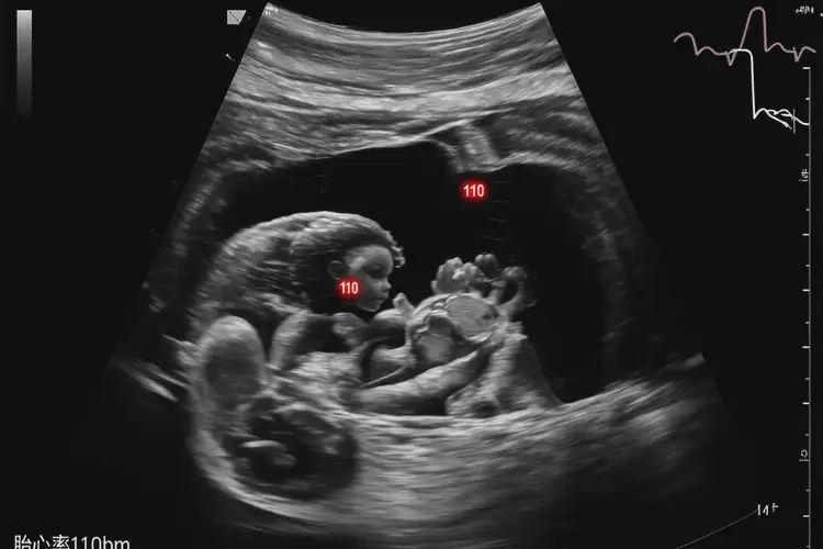 孕33周2天胎心110左右正常嗎(圖4)