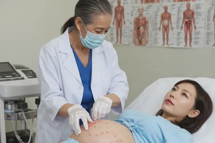 孕妇全身偶尔起湿疹可不可以彻底自愈(图3)