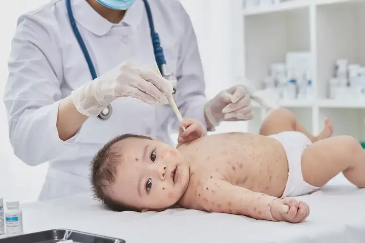 寶寶全身長濕疹不管它會自己痊愈嗎(圖3)