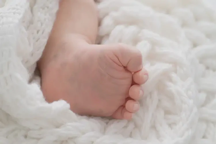 新生兒手上偶爾長濕疹能徹底自愈嗎(圖3)