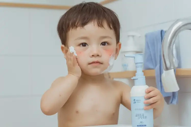 幼兒面部有濕疹能徹底自愈嗎(圖4)