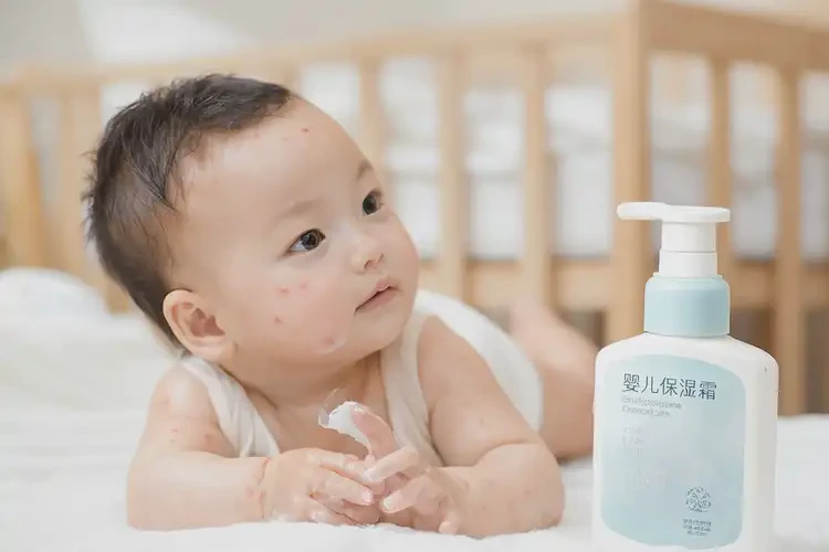 小孩身上長濕疹可不可以徹底自愈(圖4)