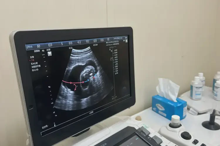 懷孕八個(gè)月胎心99怎么回事(圖3)