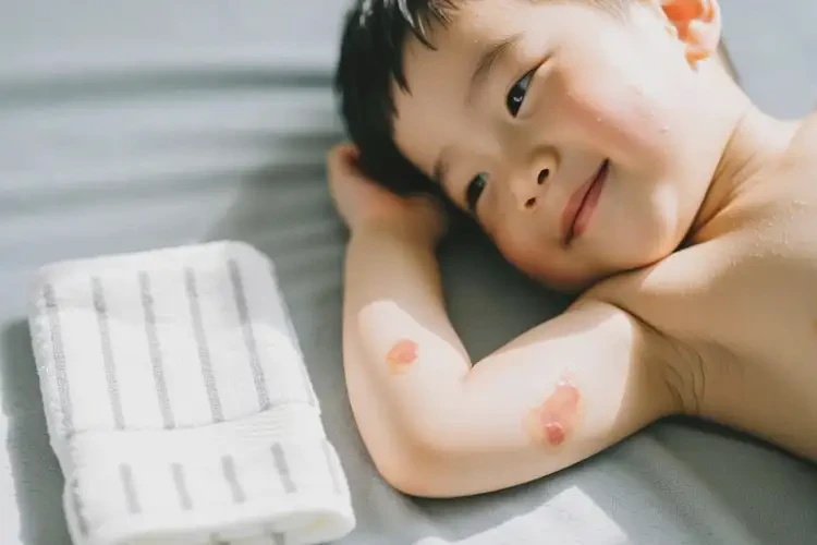 孩子手臂上的濕疹怎么治療(圖1)