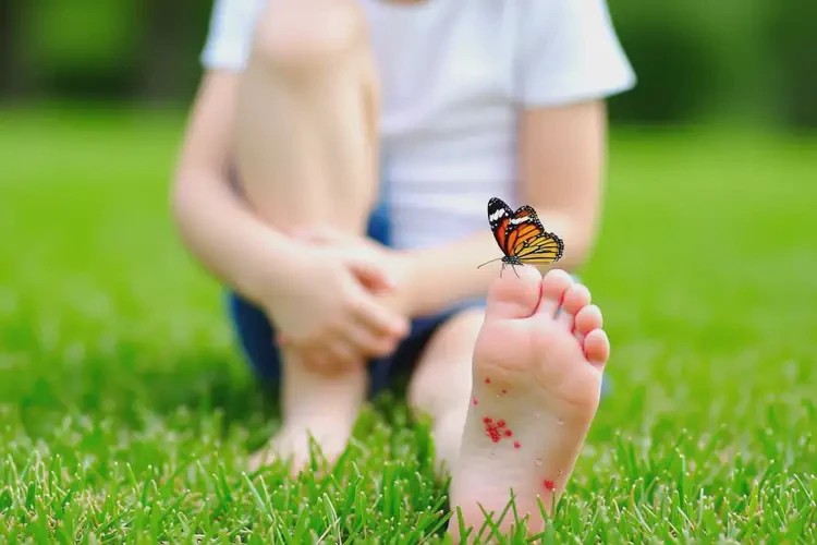 小兒腳上容易長濕疹能自愈嗎(圖1)