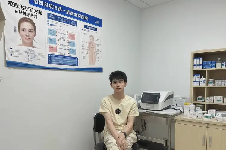 山西陽泉痤瘡治療哪個醫(yī)院含金量高(圖2)