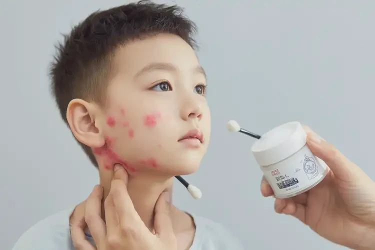 小孩脖子上起濕疹可不可以徹底自愈(圖3)
