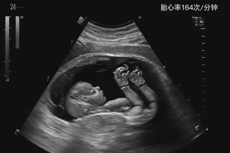 孕27周1天胎心164還要保胎嗎(圖3)