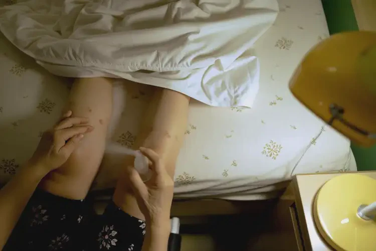 高齡老人全身出現(xiàn)濕疹治療方法(圖2)