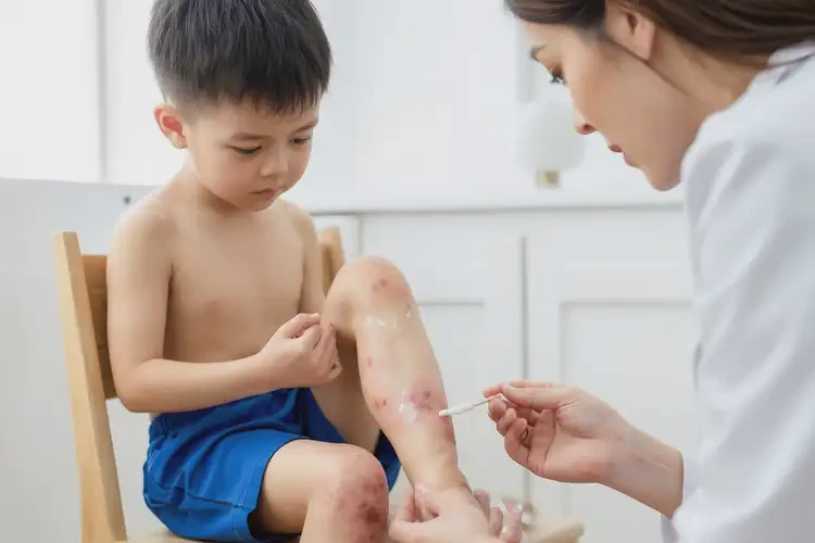 小學(xué)生小腿上容易起濕疹不管它會(huì)自己自愈嗎(圖2)