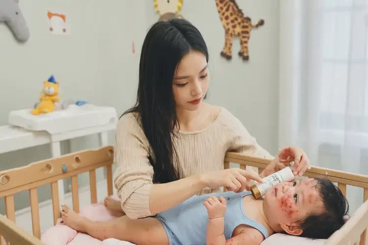 嬰兒面部經(jīng)常長濕疹可以徹底自愈嗎(圖3)