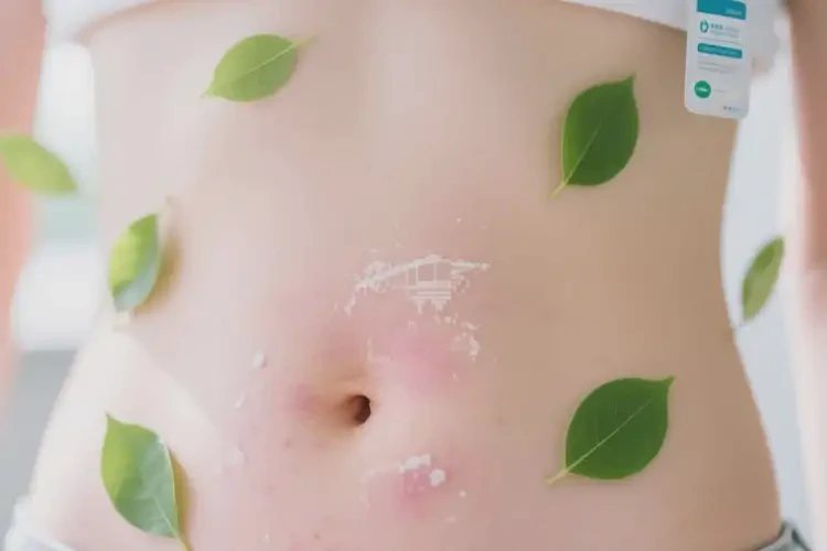 青少年肚子上容易起濕疹不管它會自己好嗎(圖4)