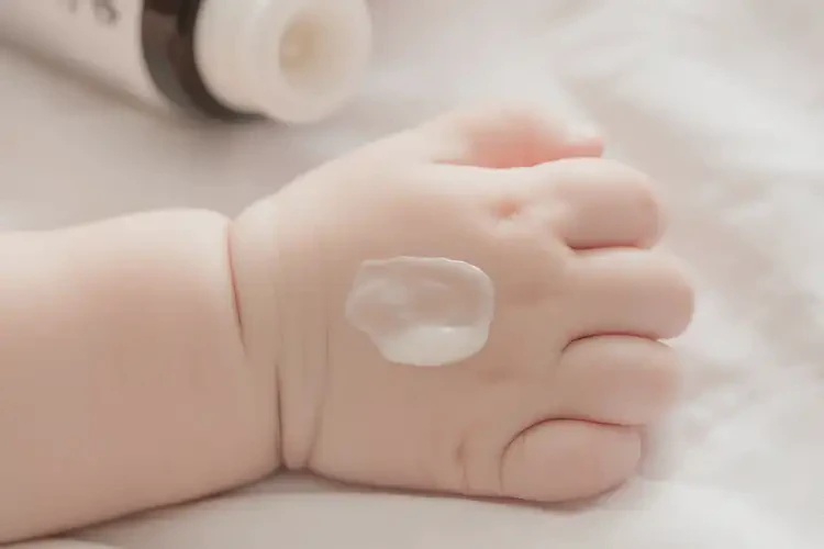 婴儿手上偶尔起湿疹能彻底自愈吗(图3)