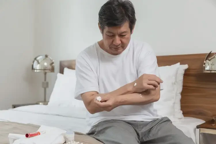 男人肛周有濕疹可不可以徹底自愈(圖1)