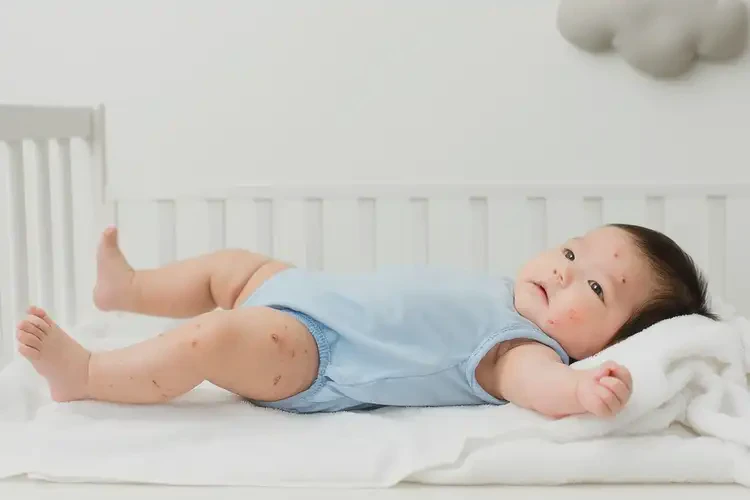 嬰兒脖子偶爾起濕疹不管它會(huì)自己好嗎(圖3)