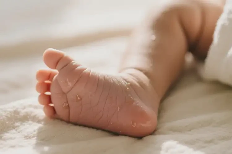 新生兒腳上偶爾長(zhǎng)濕疹能靠自己自愈嗎(圖1)