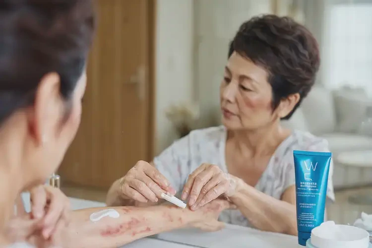 男人全身長(zhǎng)濕疹能徹底自愈嗎(圖2)