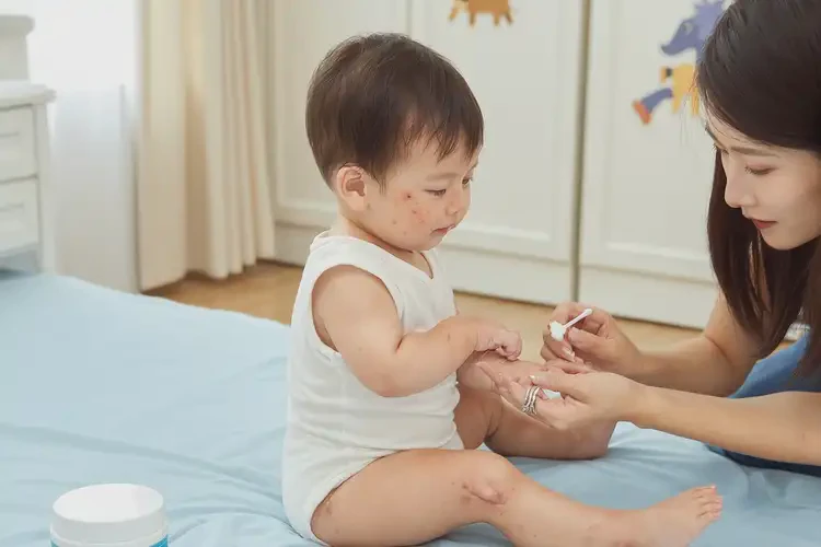 嬰幼兒臉上偶爾長濕疹能夠徹底治愈嗎(圖3)