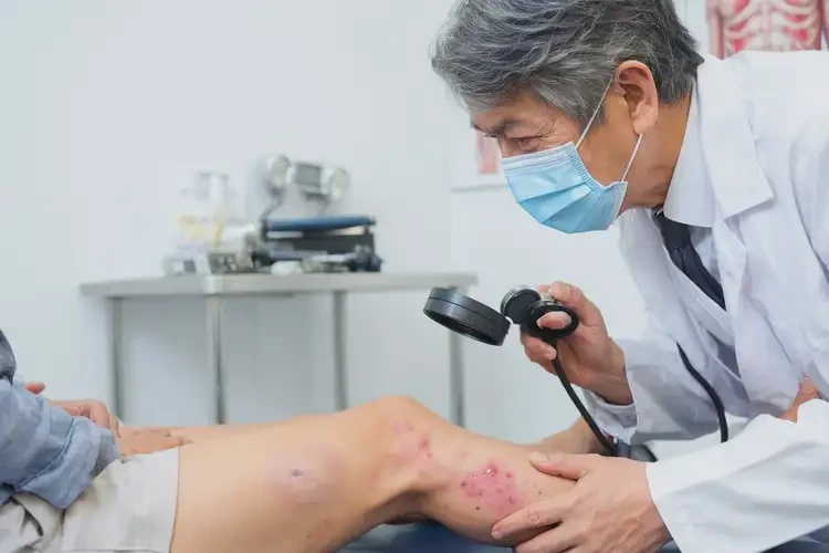 女生小腿上偶爾長濕疹不管它會自己自愈嗎(圖2)