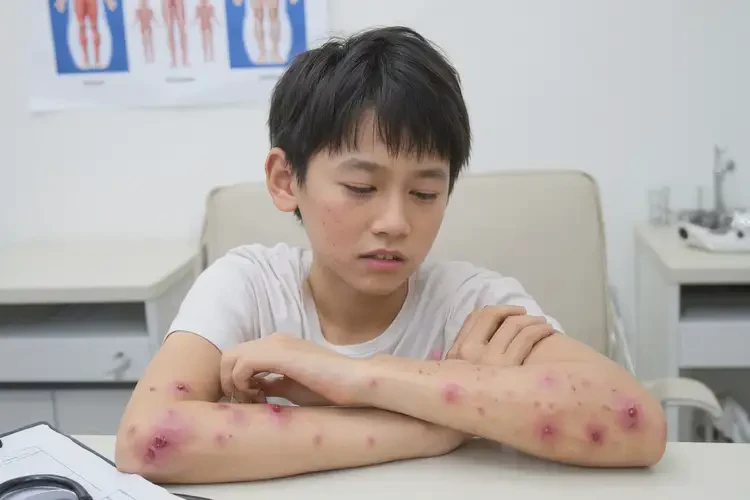 青少年手上起濕疹不管它會自己痊愈嗎(圖4)