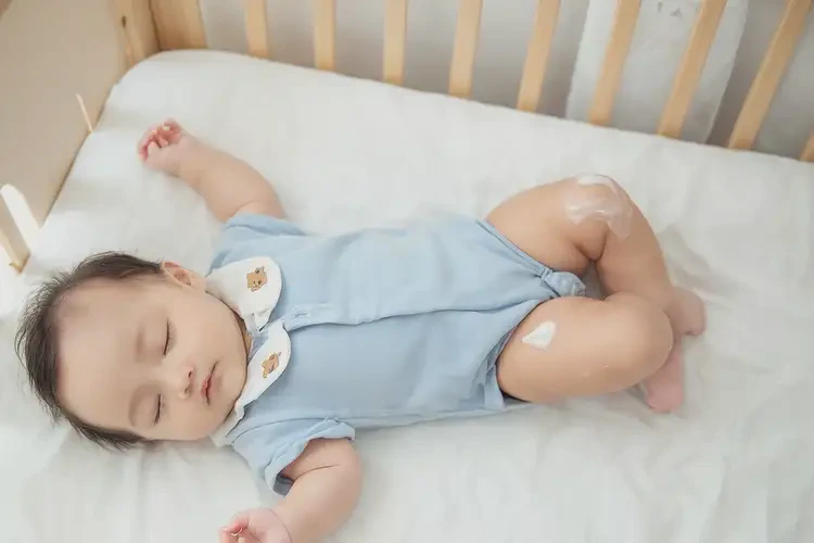 寶寶大腿上有濕疹能徹底自愈嗎(圖1)