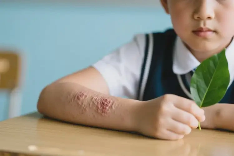 中學(xué)生手臂出濕疹能靠自己自愈嗎(圖3)