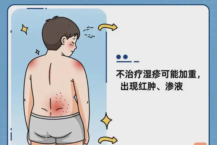 男生屁股上經(jīng)常起濕疹不管它會(huì)自己痊愈嗎(圖3)