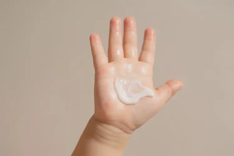 小兒手上偶爾長濕疹能靠自己自愈嗎(圖1)