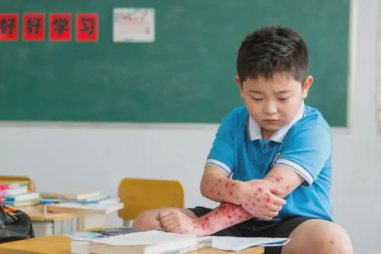 小學(xué)生四肢長濕疹能靠自己自愈嗎(圖4)