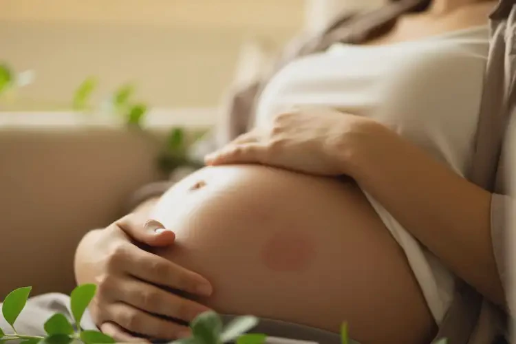 產(chǎn)婦身上有濕疹能靠自己自愈嗎(圖4)