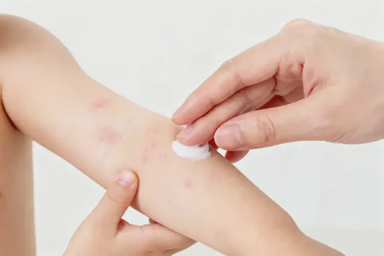 小兒手臂上偶爾起濕疹不管它會(huì)自己自愈嗎(圖4)