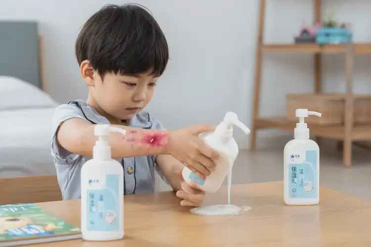 小孩手臂偶爾起濕疹能徹底自愈嗎(圖3)