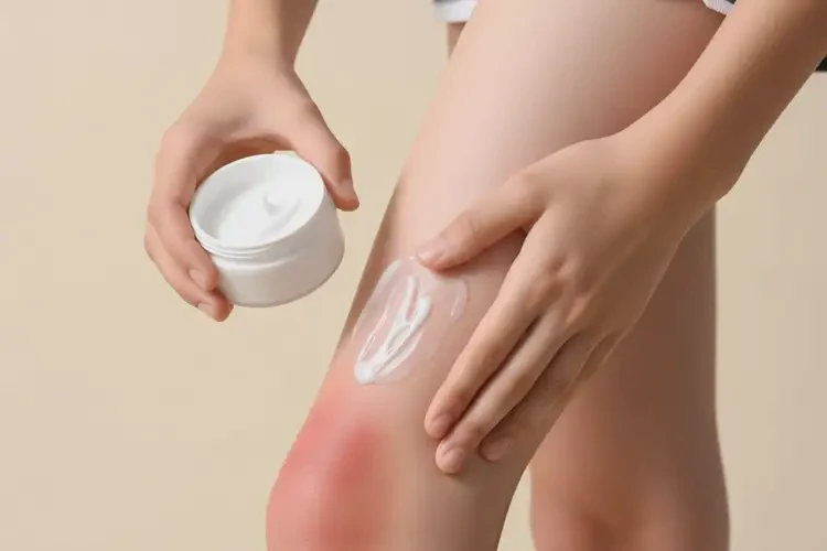 青少年大腿起濕疹能夠徹底治愈嗎(圖4)