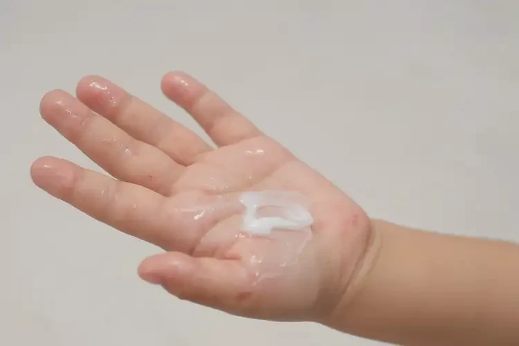 小孩手上偶爾起濕疹能靠自己自愈嗎(圖4)