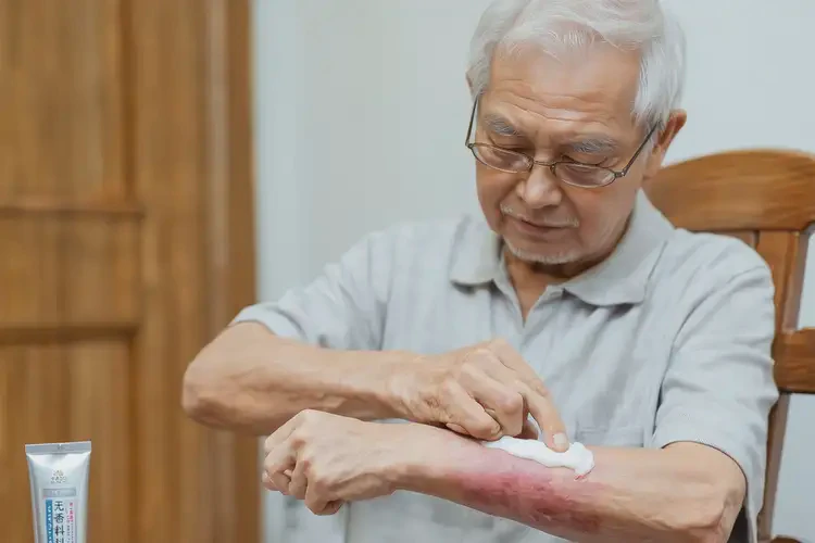 老人手臂偶爾起濕疹不管它會自己痊愈嗎(圖4)