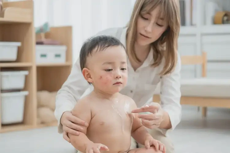 小孩屁股上有濕疹能徹底自愈嗎(圖3)