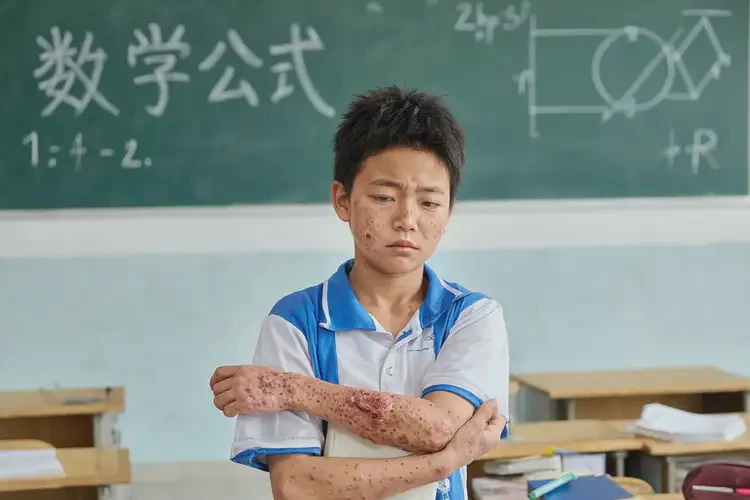 中學生四肢偶爾起濕疹不管它會自己好嗎(圖2)