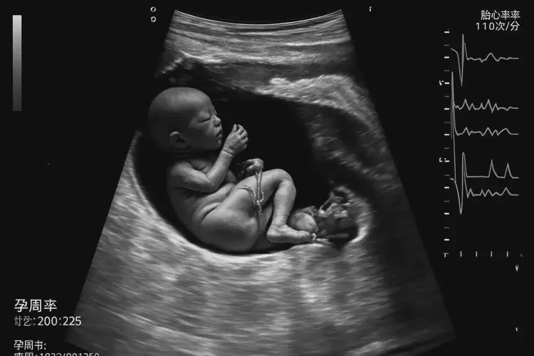 孕22周1天胎心率100有危險(xiǎn)嗎(圖4)