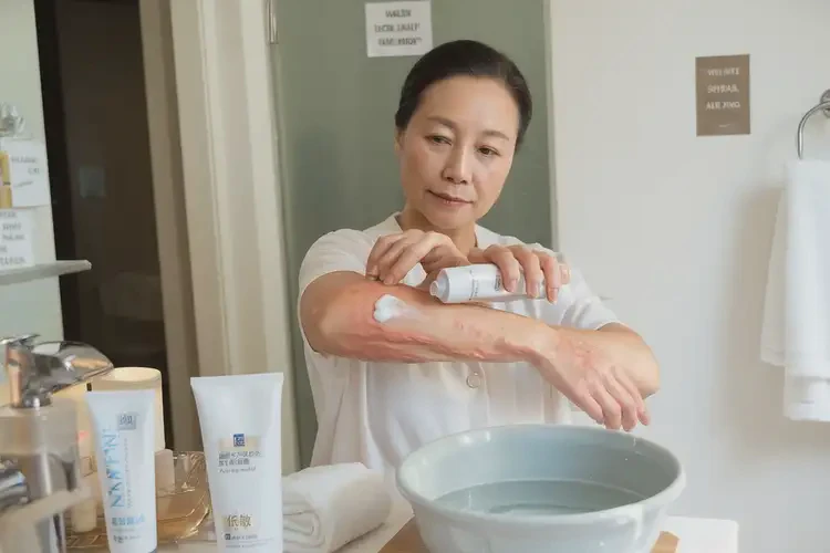 女生臉上出濕疹不管它會(huì)自己好嗎(圖1)