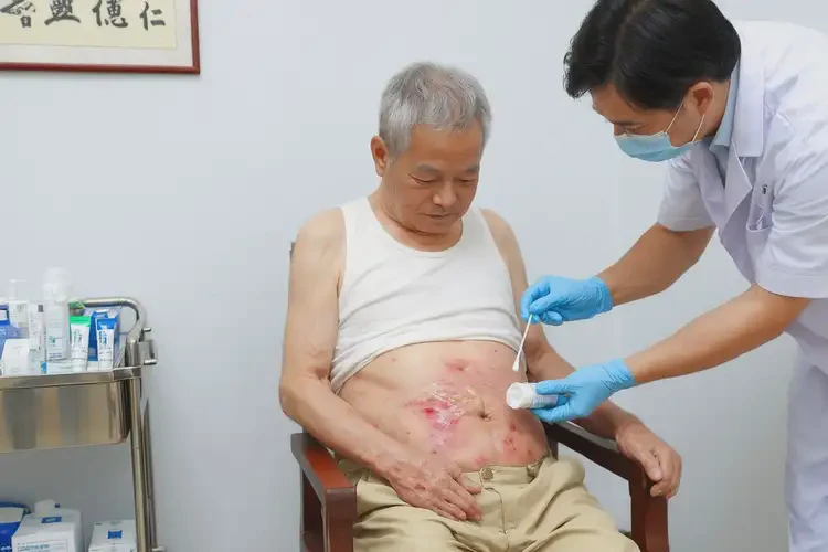 老人肚子起濕疹能靠自己自愈嗎(圖3)