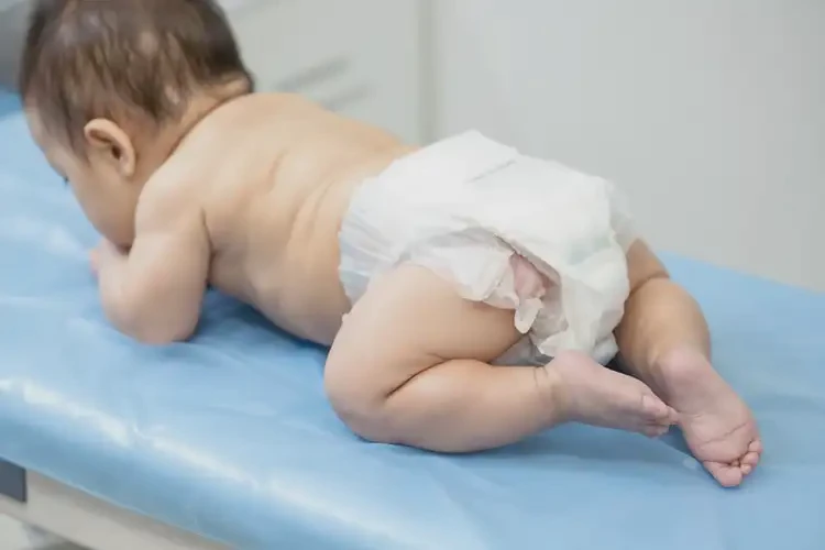 嬰兒肛周偶爾起濕疹不管它會(huì)自己痊愈嗎(圖3)