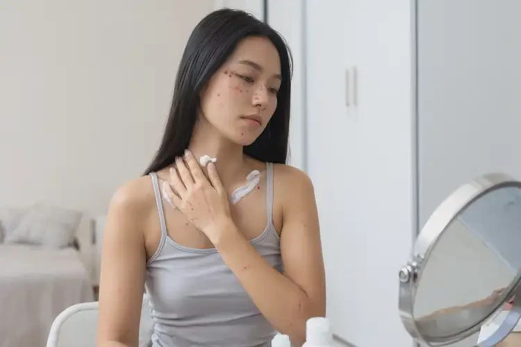 女生脖子上容易起濕疹不管它會(huì)自己好嗎(圖2)