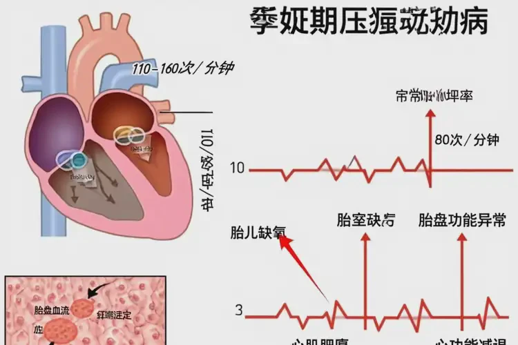 孕26周胎心率80寶寶還能要嗎(圖1)