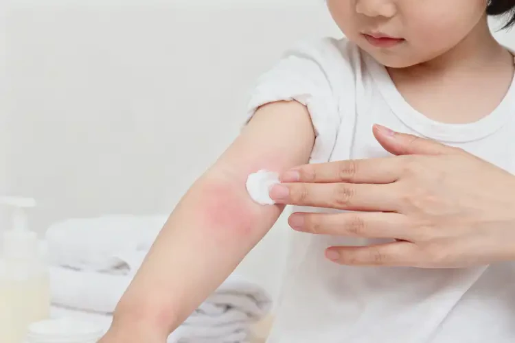 少兒手臂經(jīng)常起濕疹能靠自己自愈嗎(圖1)