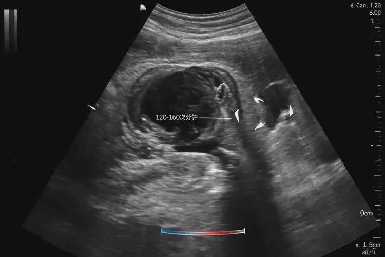 懷孕80多天胎心率83寶寶還能要嗎(圖4)