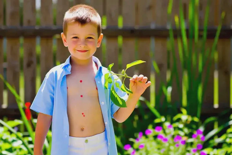 小學生全身偶爾起濕疹能徹底自愈嗎(圖1)