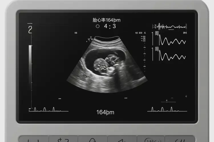 懷孕第2周胎心164還能保住嗎(圖4)