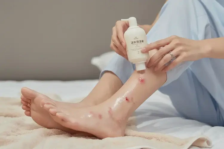 產(chǎn)婦腳上偶爾長濕疹可以徹底自愈嗎(圖3)