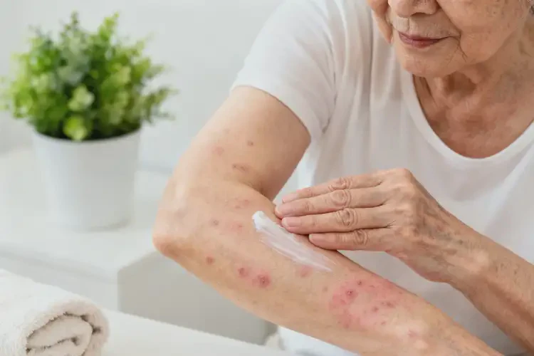 高齡老人手臂經(jīng)常起濕疹能徹底自愈嗎(圖1)