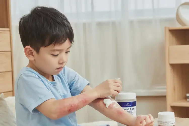 少兒全身出濕疹不管它會自己痊愈嗎(圖2)